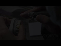 গ্রাসস্কিপটার ফিনিয়ারগুলি প্রাকৃতিক স্বচ্ছতাযুক্ত দাঁতের ফিনিয়ারগুলির জন্য নিখুঁত সমাধান