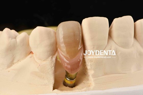 কেনা 0° কোণ সমাপ্ত দাঁত Abutments 1.5mm থ্রেড পিচ পোলিশ পৃষ্ঠ অনলাইনে উৎপাদন