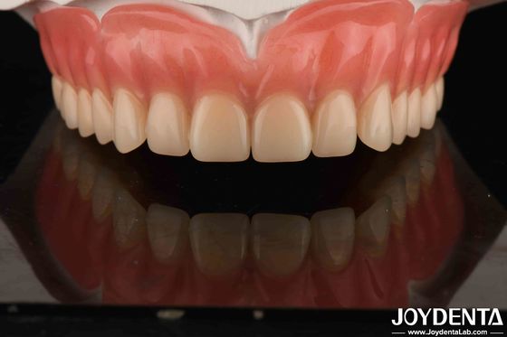 কেনা অ্যাক্রিলিক দাঁত ফিনিস হালকা ওজন রজন উপাদান দাঁত পুনরুদ্ধার দাঁত বিন্যাস অনলাইনে উৎপাদন