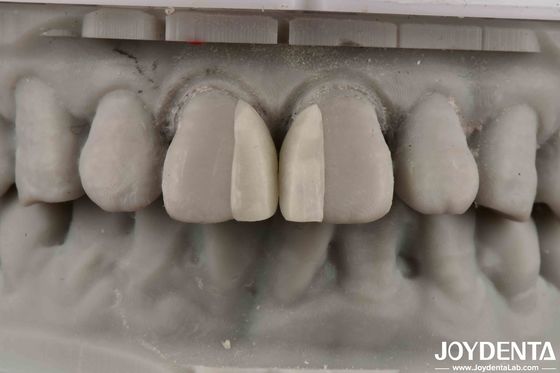 কেনা অভ্যন্তরীণ সজ্জা জন্য বাঁকা পৃষ্ঠতল অগ্নি প্রতিরোধী মাইক্রো ভিনিয়ার অনলাইনে উৎপাদন