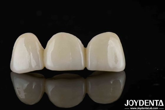 কেনা স্টাইল প্রাকৃতিক দেখায় স্তর পূর্ণ Zirconia উচ্চ স্বচ্ছতা এবং নান্দনিকতা অনলাইনে উৎপাদন