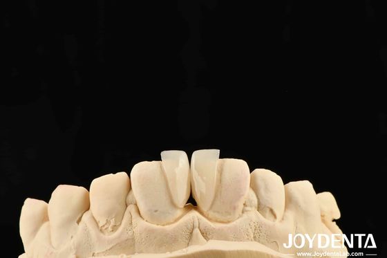 কেনা উচ্চ স্থায়িত্ব মাইক্রো ভিনিয়ার 0.2 মিমি বেধ এবং নির্ভরযোগ্য কর্মক্ষমতা অনলাইনে উৎপাদন