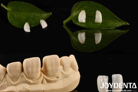 কেনা উচ্চ স্থায়িত্ব প্রাকৃতিক কাঠের সাথে অতি পাতলা মাইক্রো ফিনিয়ার 0.2 মিমি বেধ অনলাইনে উৎপাদন