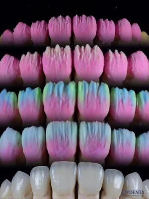 কেনা The Joydenta Ceramic Veneer Process অনলাইনে উৎপাদন