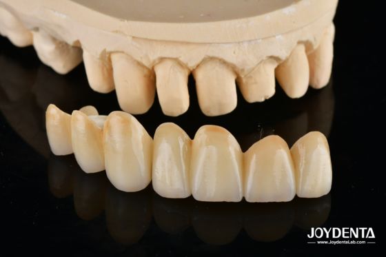 কেনা Unveil True Biomimicry: Introducing Our Multi-Layered Zirconia Aesthetic Bridge অনলাইনে উৎপাদন