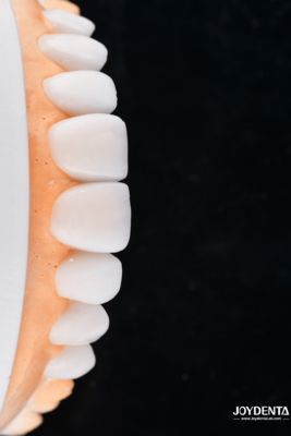 কেনা Enhance Case Acceptance & Patient Communication with Our Diagnostic Wax-Up Service অনলাইনে উৎপাদন