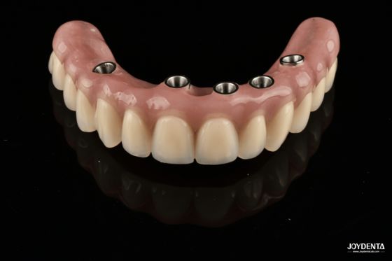 কেনা Redefining Full Arch Prosthetics: Unmatched Fit and Function with Our Ti-Base Complete Dentures অনলাইনে উৎপাদন