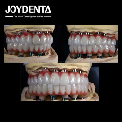 কেনা 10 মিমি টাইটানিয়াম মাল্টিপল ডেন্টাল ইমপ্লান্ট দাঁতের পুনরুদ্ধারের জন্য রুক্ষ পৃষ্ঠ অনলাইনে উৎপাদন