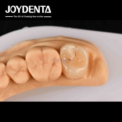 কেনা ক্ষতিগ্রস্ত দাঁত পুনরুদ্ধারের জন্য উচ্চ শক্তি Emax ইনলে অনলে A2 রঙ দীর্ঘস্থায়ী অনলাইনে উৎপাদন