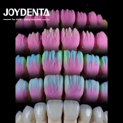 কেনা The Joydenta Ceramic Veneer Process অনলাইনে উৎপাদন