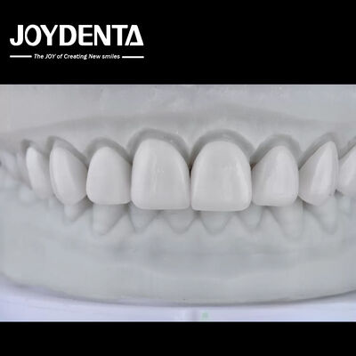 কেনা Visualize the Result, Secure the Case: Our Diagnostic Wax-Up Service অনলাইনে উৎপাদন