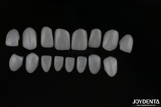 বাস্তব চেহারা গ্লাস সিরামিক দাঁত veneers সঙ্গে চকচকে বা ম্যাট পৃষ্ঠ সমাপ্তি
