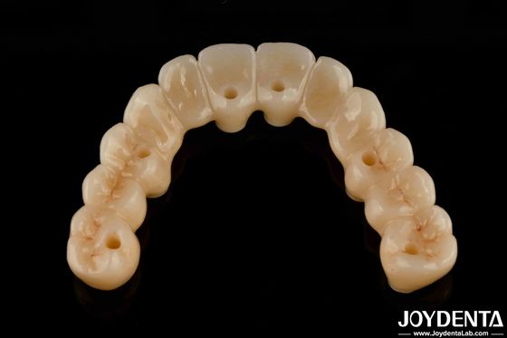 উচ্চ নমনীয়তা টাইটানিয়াম বেস সঙ্গে Zirconia হাইব্রিড ব্রিজ উচ্চ নান্দনিক
