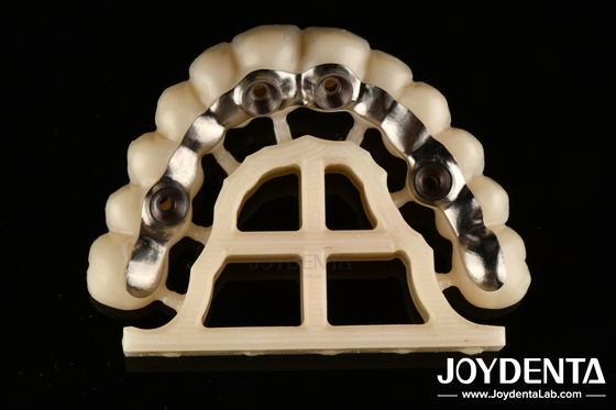 সিলভার ফিনিস কাস্টম Abutments এবং বার সঠিক ফিট স্ক্রু সংরক্ষিত বা সিমেন্ট সংরক্ষিত