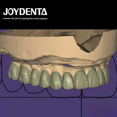 স্বতন্ত্র নকশা ডিজিটাল ডায়াগনস্টিক ওয়াক আপ ল্যাব সফটওয়্যার বিরামবিহীন ইন্টিগ্রেশন